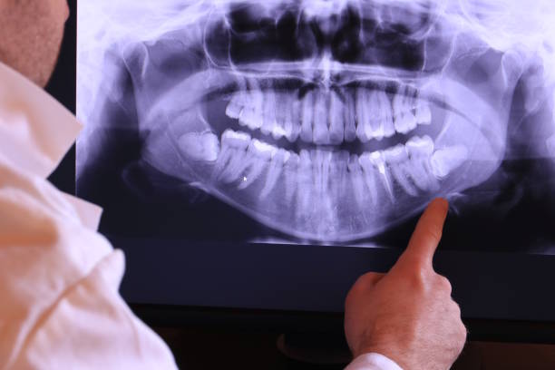 Best Orthodontic Emergency Dentist in Eastern Goleta Valley, CA