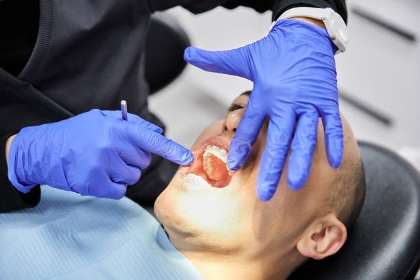 Best Emergency Dentist for Lost Fillings or Crowns in Eastern Goleta Valley, CA