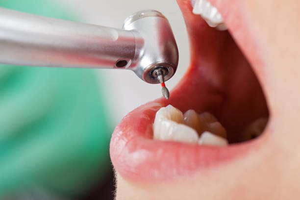 Best Weekend Emergency Dentist in Eastern Goleta Valley, CA